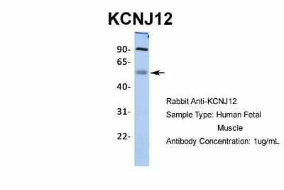 Western Blot: Kir2.2 Antibody [NBP2-87693] - Host: Rabbit. Target Name: KCNJ12. Sample Type: Human Fetal Muscle. Antibody Dilution: 1.0ug/ml