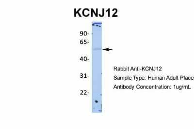 Western Blot: Kir2.2 Antibody [NBP2-87693] - Host: Rabbit. Target Name: KCNJ12. Sample Type: Human Adult Placenta. Antibody Dilution: 1.0ug/ml