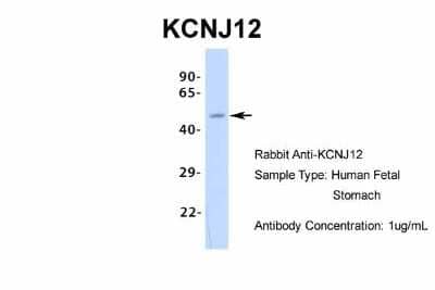 Western Blot: Kir2.2 Antibody [NBP2-87693] - Host: Rabbit. Target Name: KCNJ12. Sample Type: Human Fetal Stomach. Antibody Dilution: 1.0ug/ml