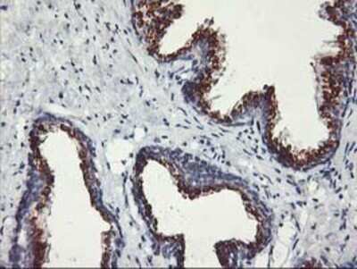 Immunohistochemistry: Kir3.1 Antibody (OTI1G3) - Azide and BSA Free [NBP2-71065] - Staining of paraffin-embedded Human prostate tissue using anti-Kir3.1 mouse monoclonal antibody.