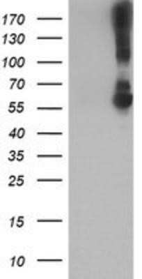 Western Blot: Kir3.1 Antibody (OTI1G3) - Azide and BSA Free [NBP2-71065] - HEK293T cells were transfected with the pCMV6-ENTRY control (Left lane) or pCMV6-ENTRY Kir3.1 (Right lane) cDNA for 48 hrs and lysed. Equivalent amounts of cell lysates (5 ug per lane) were separated by SDS-PAGE and immunoblotted with anti-Kir3.1.