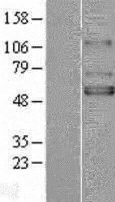 Western Blot: Kir3.1 Overexpression Lysate (Adult Normal) [NBL1-12170] - Left - Empty vector transfected control cell lysate (HEK293 cell lysate); Right - Over-expression Lysate for Kir3.1.