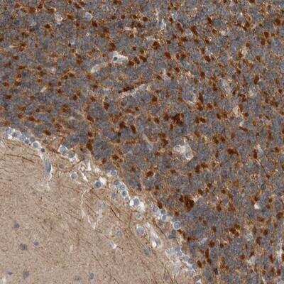 Immunohistochemistry: Kir3.1 Antibody [NBP1-89770] - Staining of human cerebellum shows strong cytoplasmic positivity in granular layer cells.