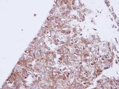 Immunohistochemistry-Paraffin: Kir3.1 Antibody [NBP1-32958] - Paraffin-embedded DU145 xenograft, using antibody at 1:100 dilution.