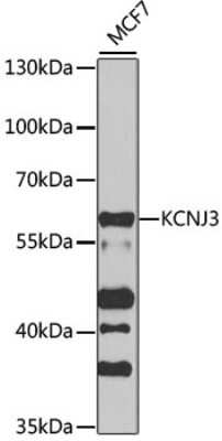 Western Blot: Kir3.1 Antibody [NBP3-03002] - Analysis of extracts of MCF7 cells, using Kir3.1 antibody at 1:1000 dilution. Secondary antibody: HRP Goat Anti-Rabbit IgG (H+L) at 1:10000 dilution. Lysates/proteins: 25ug per lane. Blocking buffer: 3% nonfat dry milk in TBST. Detection: ECL Basic Kit .