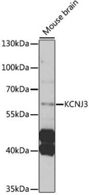 Western Blot: Kir3.1 Antibody [NBP3-03002] - Analysis of extracts of mouse brain, using Kir3.1 antibody at 1:1000 dilution. Secondary antibody: HRP Goat Anti-Rabbit IgG (H+L) at 1:10000 dilution. Lysates/proteins: 25ug per lane. Blocking buffer: 3% nonfat dry milk in TBST. Detection: ECL Enhanced Kit