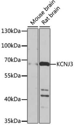 Western Blot: Kir3.1 Antibody [NBP3-03003] - Analysis of extracts of various cell lines, using Kir3.1 antibody at 1:1000 dilution. Secondary antibody: HRP Goat Anti-Rabbit IgG (H+L) at 1:10000 dilution. Lysates/proteins: 25ug per lane. Blocking buffer: 3% nonfat dry milk in TBST.