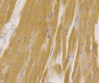 Immunohistochemistry: Kir3.4 Antibody [NBP2-76943] - Immunohistochemical analysis of paraffin-embedded rat heart tissue using anti-Kir3.4 antibody. Counter stained with hematoxylin.
