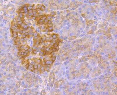 Immunohistochemistry: Kir3.4 Antibody [NBP2-76943] - Immunohistochemical analysis of paraffin-embedded human pancreas tissue using anti-Kir3.4 antibody. Counter stained with hematoxylin.