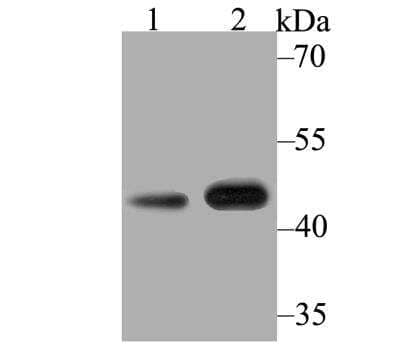 Western Blot: Kir3.4 Antibody [NBP2-76943] - Western blot analysis of Kir3.4 on different lysates using anti-Kir3.4 antibody at 1/500 dilution.Positive control:Lane1: Mouse heart Lane2: Rat heart