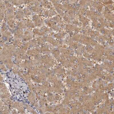 Immunohistochemistry-Paraffin: Kir6.1 Antibody [NBP1-87710] - Staining of human liver shows moderate cytoplasmic positivity in hepatocytes.