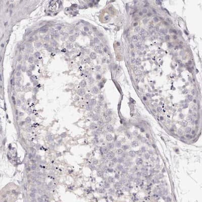 Immunohistochemistry-Paraffin: Kir6.1 Antibody [NBP1-87710] - Staining of human testis shows very weak cytoplasmic positivity in cells in seminiferous ducts.