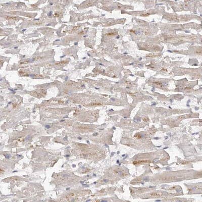 Immunohistochemistry-Paraffin: Kir6.1 Antibody [NBP1-87710] - Staining of human heart muscle shows weak to moderate cytoplasmic positivity in cardiomyocytes.