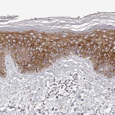 Immunohistochemistry-Paraffin: Kir6.1 Antibody [NBP1-87710] - Staining of human skin shows moderate cytoplasmic positivity in squamous epithelial cells.