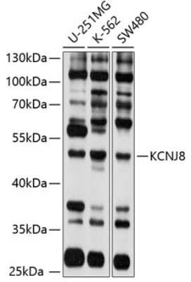 Western Blot: Kir6.1 Antibody [NBP3-03677] - Analysis of extracts of various cell lines, using Kir6.1 antibody at 1:1000 dilution. Secondary antibody: HRP Goat Anti-Rabbit IgG (H+L) at 1:10000 dilution. Lysates/proteins: 25ug per lane. Blocking buffer: 3% nonfat dry milk in TBST. Detection: ECL Basic Kit.