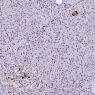 Immunohistochemistry-Paraffin: Kir6.2 Antibody [NBP2-33540] - Staining of human pancreas shows strong cytoplasmic positivity in a subset of cells in islets of Langerhans.