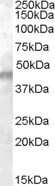 Western Blot: Kir6.2 Antibody [NB100-93410] - Analysis of Kir6.2 in Human Muscle lysate (35ug protein in RIPA buffer) using NB100-93410 at 0.1ug/ml. Primary incubation was 1 hour. Detected by chemiluminescence.