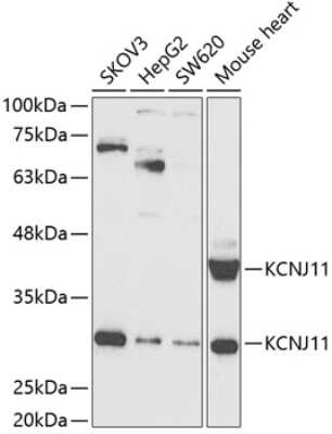 Western Blot: Kir6.2 Antibody [NBP3-03506] - Analysis of extracts of various cell lines, using Kir6.2 antibody at 1:1000 dilution. Secondary antibody: HRP Goat Anti-Rabbit IgG (H+L) at 1:10000 dilution. Lysates/proteins: 25ug per lane. Blocking buffer: 3% nonfat dry milk in TBST. Detection: ECL Basic Kit.