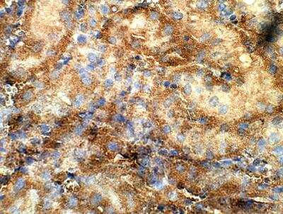 Immunohistochemistry-Paraffin Kirrel1/NEPH1 Antibody