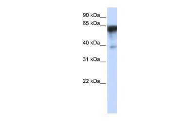 Western Blot: Kirrel1/NEPH1 Antibody [NBP1-91309] - WB Suggested Anti-KIRREL Antibody Titration: 0.2-1 ug/ml. ELISA Titer: 1:312500. Positive Control: HepG2 cell lysate