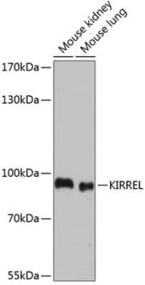 Western Blot: Kirrel1/NEPH1 Antibody [NBP3-03509] - Analysis of extracts of various cell lines, using Kirrel1/NEPH1 antibody at 1:1000 dilution. Secondary antibody: HRP Goat Anti-Rabbit IgG (H+L) at 1:10000 dilution. Lysates/proteins: 25ug per lane. Blocking buffer: 3% nonfat dry milk in TBST.
