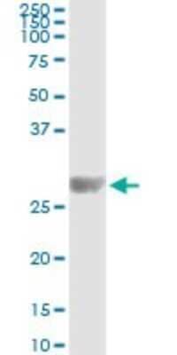 Immunoprecipitation: Kirrel2/NEPH3 Antibody (2B9-1D3) [H00084063-M01] - Analysis of KIRREL2 transfected lysate using anti-KIRREL2 monoclonal antibody and Protein A Magnetic Bead, and immunoblotted with KIRREL2 MaxPab rabbit polyclonal antibody.