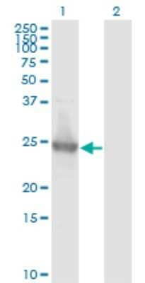 Western Blot: Kirrel2/NEPH3 Antibody (2B9-1D3) [H00084063-M01] - Analysis of KIRREL2 expression in transfected 293T cell line by KIRREL2 monoclonal antibody (M01), clone 2B9-1D3.Lane 1: KIRREL2 transfected lysate (Predicted MW: 23.6 KDa).Lane 2: Non-transfected lysate.