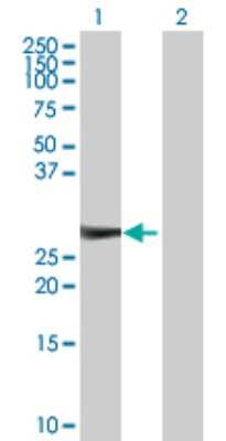 Western Blot: Kirrel2/NEPH3 Antibody [H00084063-D01P] - Analysis of KIRREL2 expression in transfected 293T cell line by KIRREL2 polyclonal antibody.Lane 1: KIRREL2 transfected lysate(23.60 KDa).Lane 2: Non-transfected lysate.