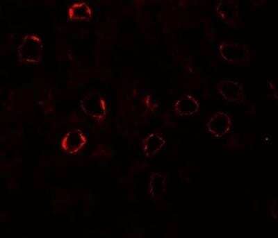 Immunocytochemistry/ Immunofluorescence Kirrel3/NEPH2 Antibody - BSA Free