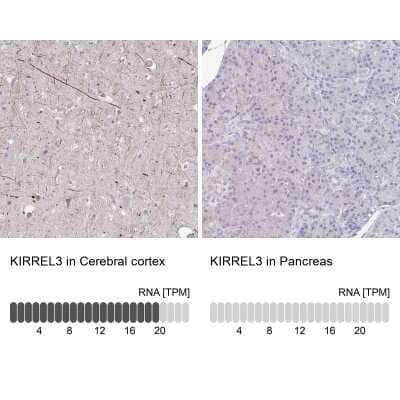 Immunohistochemistry-Paraffin: Kirrel3/NEPH2 Antibody [NBP2-38788] - Staining in human cerebral cortex and pancreas tissues using anti-KIRREL3 antibody. Corresponding KIRREL3 RNA-seq data are presented for the same tissues.