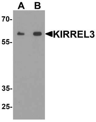 Western Blot Kirrel3/NEPH2 Antibody - BSA Free