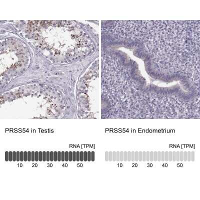 Immunohistochemistry-Paraffin: Klkbl4 Antibody [NBP1-88043] - Staining in human testis and endometrium tissues using anti-PRSS54 antibody. Corresponding PRSS54 RNA-seq data are presented for the same tissues.