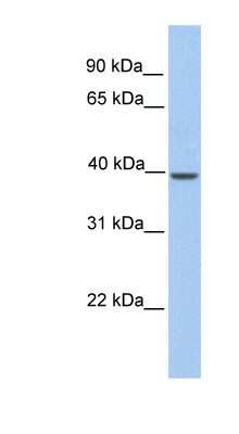 Western Blot: Klkbl4 Antibody [NBP1-57617] - Human Muscle lysate, concentration 0.2-1 ug/ml.