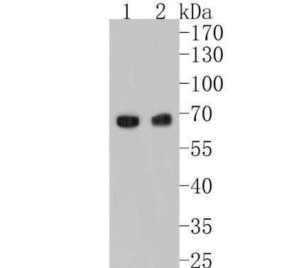 Western Blot: Klotho Antibody (JM93-76) [NBP2-75551] - Analysis of Klotho on different lysates. Proteins were transferred to a PVDF membrane and blocked with 5% BSA in PBS for 1 hour at room temperature. The primary antibody (1/500) was used in 5% BSA at room temperature for 2 hours. Goat Anti-Rabbit IgG - HRP Secondary Antibody at 1:5,000 dilution was used for 1 hour at room temperature. Positive control:  Lane 1: human serum lysateLane 2: human kidney tissue lysate