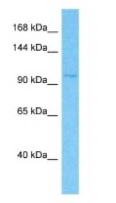 Western Blot: Klotho beta Antibody [NBP3-09315] - Western blot analysis of Klotho beta in 721_B Whole Cell lysates. Antibody dilution at 0.5ug/ml