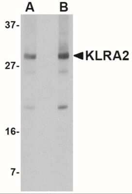 Western Blot: Klra2 Antibody [NBP2-41096] - Western blot analysis of KLRA2 in mouse spleen tissue lysate with KLRA2 antibody at (A) 0.5 and (B) 1 ug/mL.