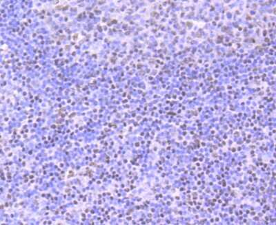Immunohistochemistry-Paraffin: Ku70/XRCC6 Antibody (JM61-31) [NBP2-66920] - Analysis of paraffin-embedded human tonsil tissue using anti-Ku 70 antibody. Counter stained with hematoxylin.