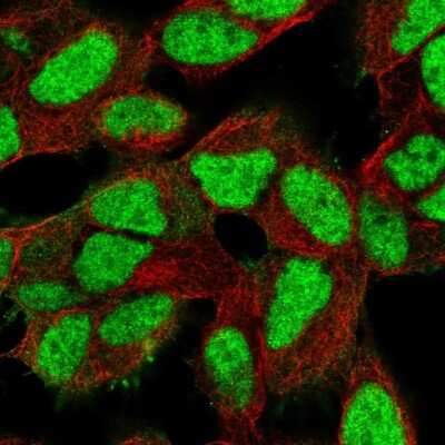 Immunocytochemistry/Immunofluorescence: Ku80/XRCC5 Antibody [NBP2-55954] - Staining of human cell line SH-SY5Y shows localization to nucleoplasm.