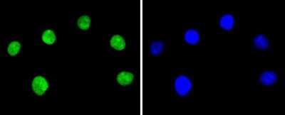 Immunocytochemistry/Immunofluorescence: Ku80/XRCC5 Antibody (SC06-14) [NBP2-67583] - Staining Ku80 in A549 cells (green). The nuclear counter stain is DAPI (blue). Cells were fixed in paraformaldehyde, permeabilised with 0.25% Triton X100/PBS.