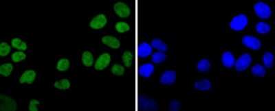Immunocytochemistry/Immunofluorescence: Ku80/XRCC5 Antibody (SC06-14) [NBP2-67583] - Staining Ku80 in Hela cells (green). The nuclear counter stain is DAPI (blue). Cells were fixed in paraformaldehyde, permeabilised with 0.25% Triton X100/PBS.