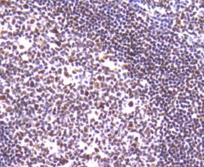 Immunohistochemistry-Paraffin: Ku80/XRCC5 Antibody (SC06-14) [NBP2-67583] - Analysis of paraffin-embedded human tonsil tissue using anti-Ku80 antibody. Counter stained with hematoxylin.