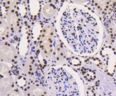 Immunohistochemistry-Paraffin: Ku80/XRCC5 Antibody (SC06-14) [NBP2-67583] - Immunohistochemical analysis of paraffin-embedded human kidney tissue using anti-Ku80/XRCC5 antibody. Counter stained with hematoxylin.