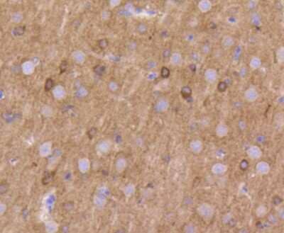 Immunohistochemistry-Paraffin: Kv1.1 Antibody (SN66-06) [NBP2-67704] - Analysis of paraffin-embedded rat brain tissue using anti-Kv1.1 potassium channel antibody. Counter stained with hematoxylin.
