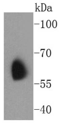 Western Blot: Kv1.1 Antibody (SN66-06) [NBP2-67704] - Analysis of Kv1.1 potassium channel on human brain lysates using anti-Kv1.1 potassium channel antibody at 1/1,000 dilution.