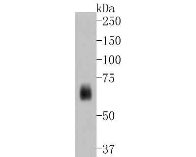 Western Blot: Kv1.1 Antibody (SN66-06) [NBP2-67704] - Western blot analysis of Kv1.1 on human brain tissue lysates. Proteins were transferred to a PVDF membrane and blocked with 5% BSA in PBS for 1 hour at room temperature. The primary antibody (1/500) was used in 5% BSA at room temperature for 2 hours. Goat