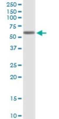 Western Blot: Kv1.1 Antibody [H00003736-B01P] - Analysis of KCNA1 expression in A-431.