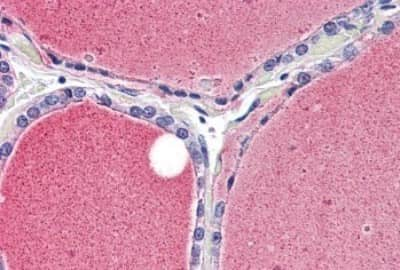 Immunohistochemistry-Paraffin: Kv1.3 Antibody [NBP3-14388] - Immunohistochemistry of formalin-fixed, paraffin-embedded human thyroid after heat-induced antigen retrieval.