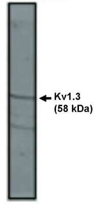 Western Blot: Kv1.3 Antibody [NBP3-11898] - Western blot analysis using Kv1.3 antibody on rat brain lysate.