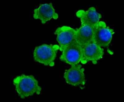 Immunocytochemistry/Immunofluorescence: Kv1.4 Antibody [NBP2-75552] - Staining Kv1.4 in N2A cells (green). The nuclear counter stain is DAPI (blue). Cells were fixed in paraformaldehyde, permeabilised with 0.25% Triton X100/PBS.