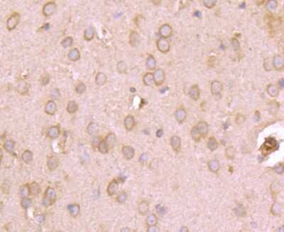 Immunohistochemistry-Paraffin: Kv1.4 Antibody [NBP2-75552] - Analysis of paraffin-embedded mouse brain tissue using anti-Kv1.4 antibody. Counter stained with hematoxylin.